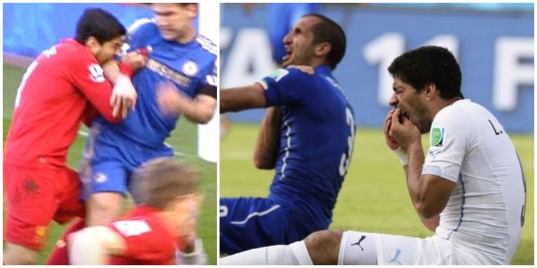 حادثة عض لويس سواريز لويس سواريز