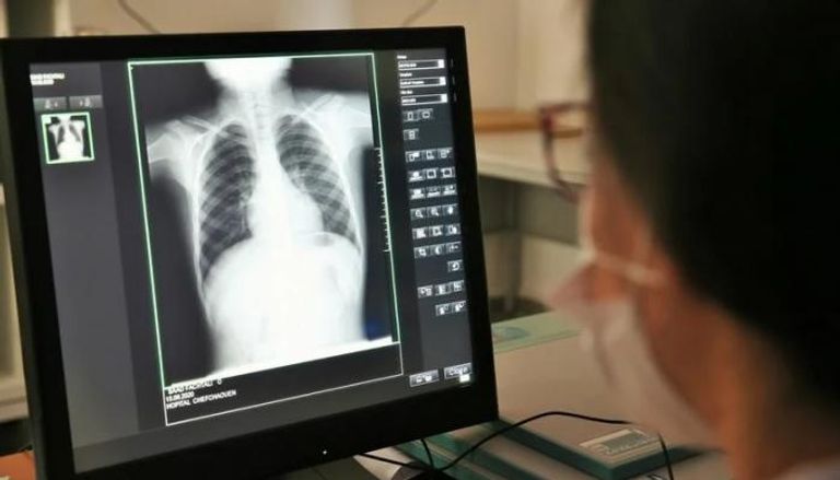 طبيبة تستعرض فحص الرئتين لأحد المرضى