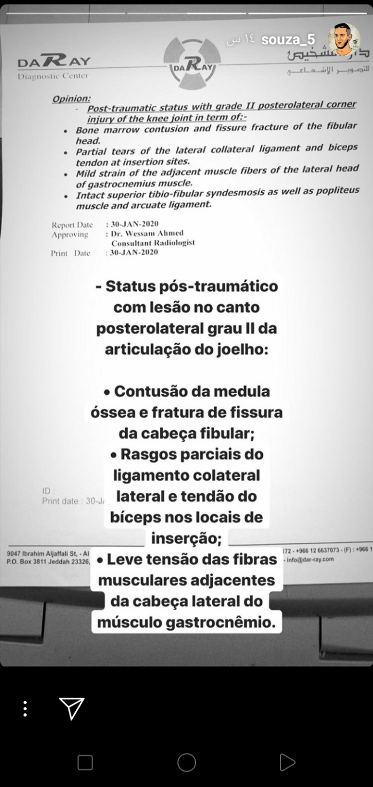 جوزيف دي سوزا