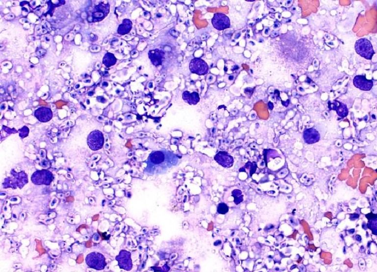 فطر المستخفية المورمة ينجذب نحو الإشعاع مفاعل تشيرنوبل يحتضن فطر غريب - أرشيفية