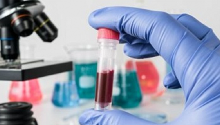 لا توجد أغذية خارقة يمكن أن تمنع الإصابة بمرض السرطان