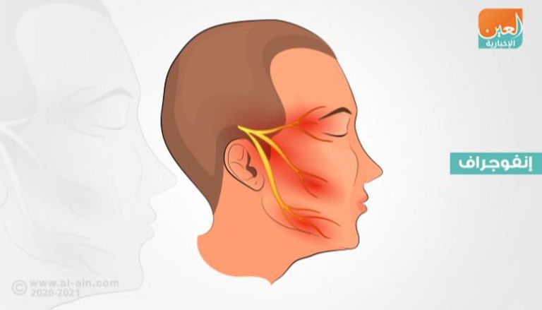 العصب الخامس يسبب نوبات ألم شديدة في الوجه والرأس