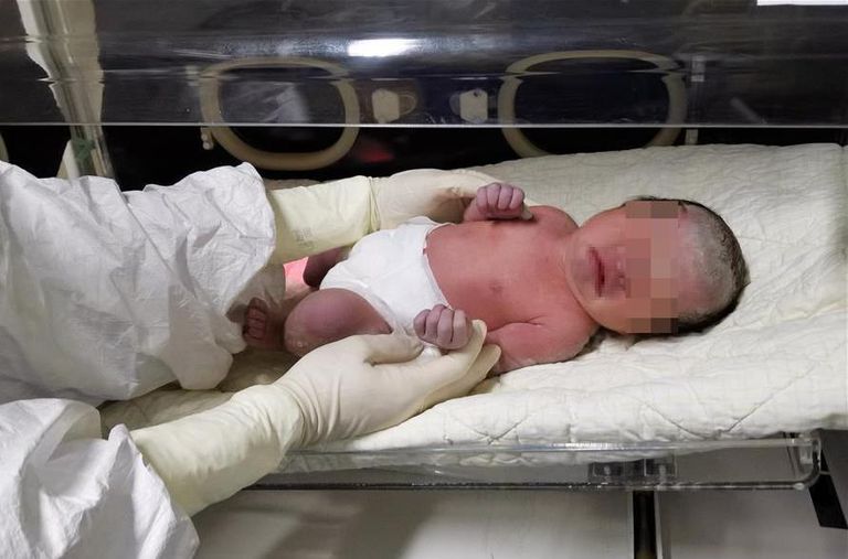 الأطباء ينقلون الطفلة