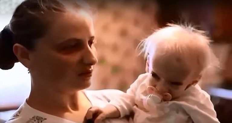 آنا توفيت بمرض وراثي نادر للغاية