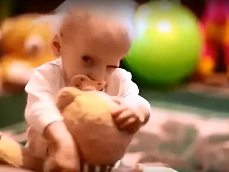 آنا توفيت بمرض وراثي نادر للغاية