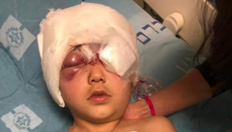 الطفل الفلسطيني مالك ضحية رصاص الاحتلال الإسرائيلي