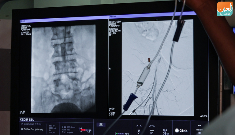 جانب من عمل الوفد الطبي المصري في إثيوبيا