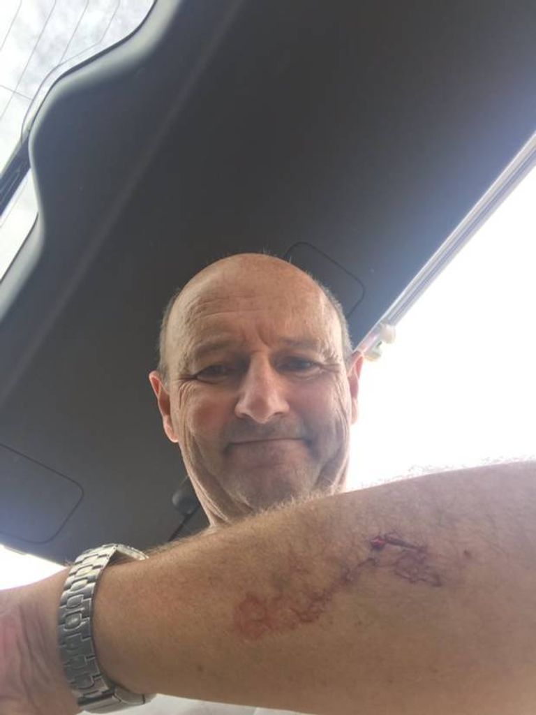 نيوزيلندي يلكم قرشا أبيض عضه في ذراعه