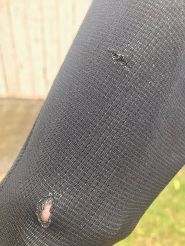 نيوزيلندي يلكم قرشا أبيض عضه في ذراعه