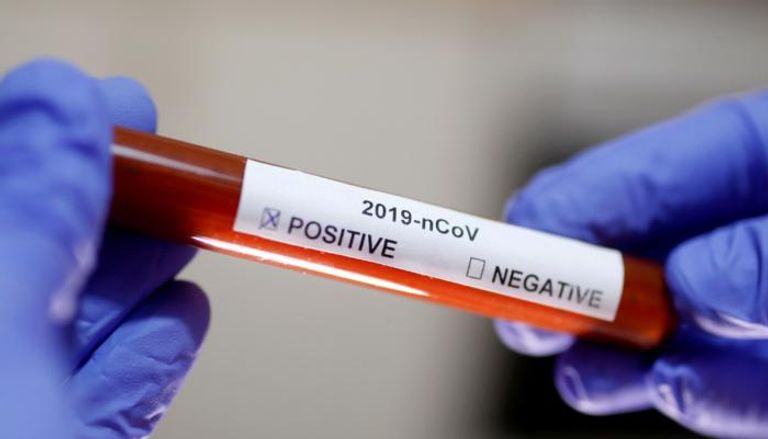 أنبوب اختبار لعينة إيجابية لفيروس "كورونا"