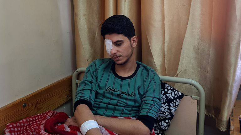 الطفل محمد أبو ريدة أحد الذين فقدوا عيونهم