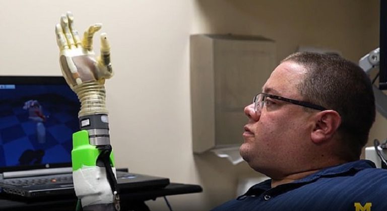 الذراع الصناعية الجديدة