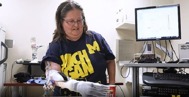 الذراع الصناعية الجديدة