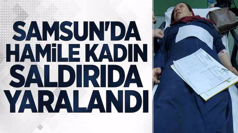 لاجئون في تركيا - أرشيفية