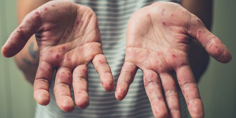 لا ترسل ابنك إلى المدرسة في 5 حالات