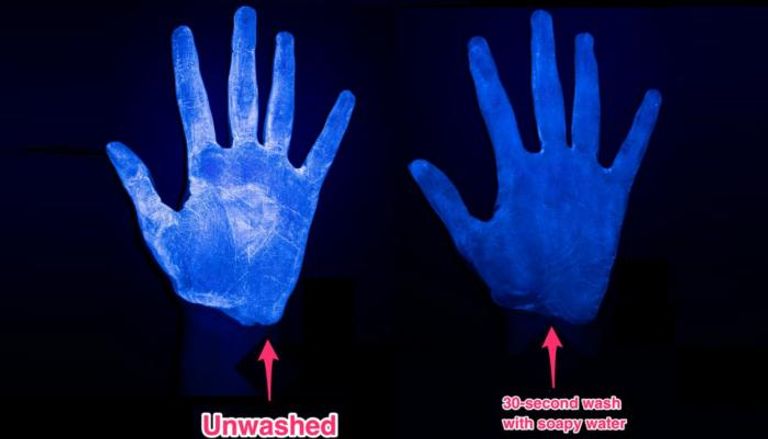 الصور تظهر اختفاء الجراثيم بعد غسل اليدين بالصابون