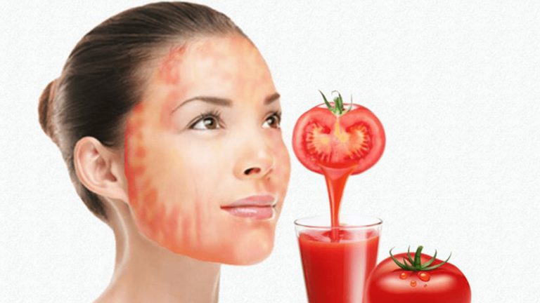 الطماطم للتخلص من دهون البشرة كيفية التخلص من دهون البشرة بطرق طبيعية