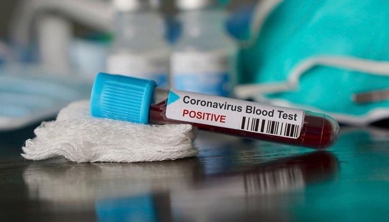 9 إصابات جديدة بفيروس كورونا في عُمان