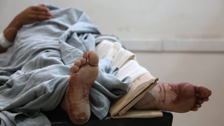 عناصر من مليشيات الحوثي تقوم بترهيب الشارع اليمني في صنعاء