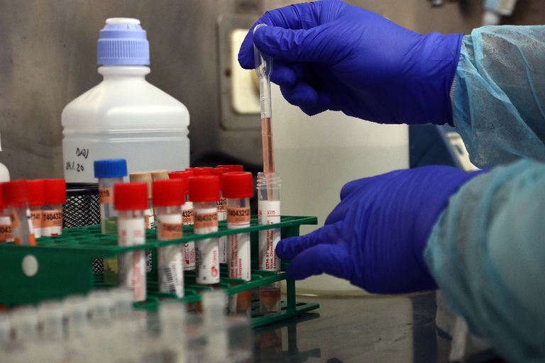 اكتشاف موقع متطابق بين سارس وكورونا الجديد يستهدفه الجسم المضاد