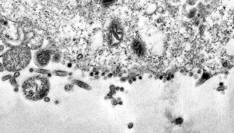 صور مجهرية لفيروس كورونا أثناء إصابة خلية سليمة بالعدوى - تليجراف