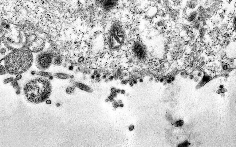 سلسلة من النقاط السوداء هي بالفعل الجزيئات الفيروسية لمرض كوفيد-19، تحاول تلك الجزيئات إصابة ودخول سيتوبلازم الخلية – الموجود بداخلها نواة الخلية التي تحتوي على المادة الجينية. صور مجهرية لفيروس كورونا أثناء إصابة خلية سليمة بالعدوى - تليجراف