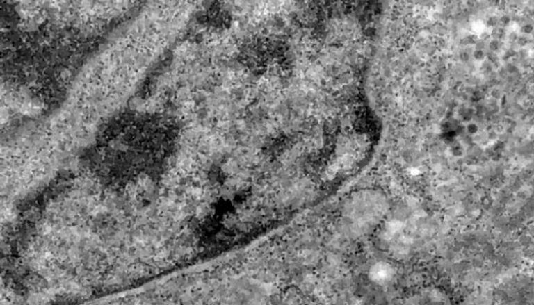 صورة مجهرية لإصابة فيروس كورونا المستجد لخلية - أرشيفية