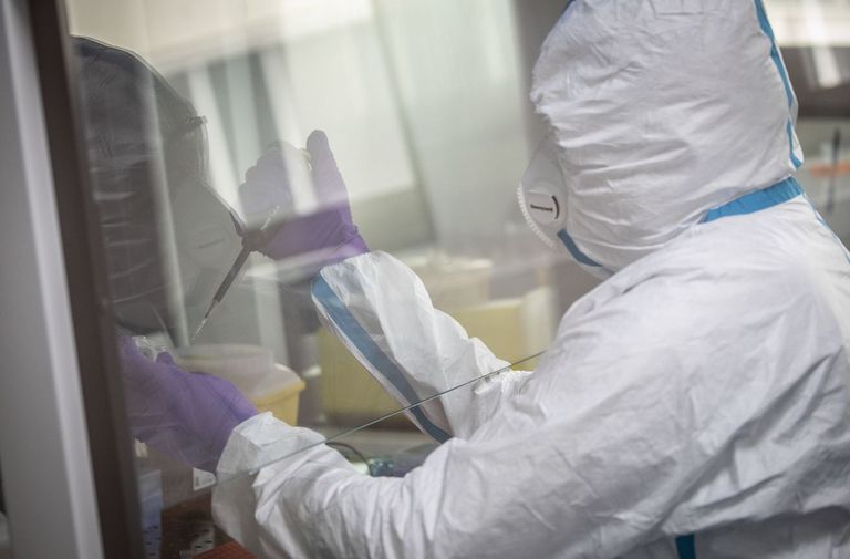 محاولات عالمية مستمرة لاكتشاف علاج لفيروس كورونا - أرشيفية