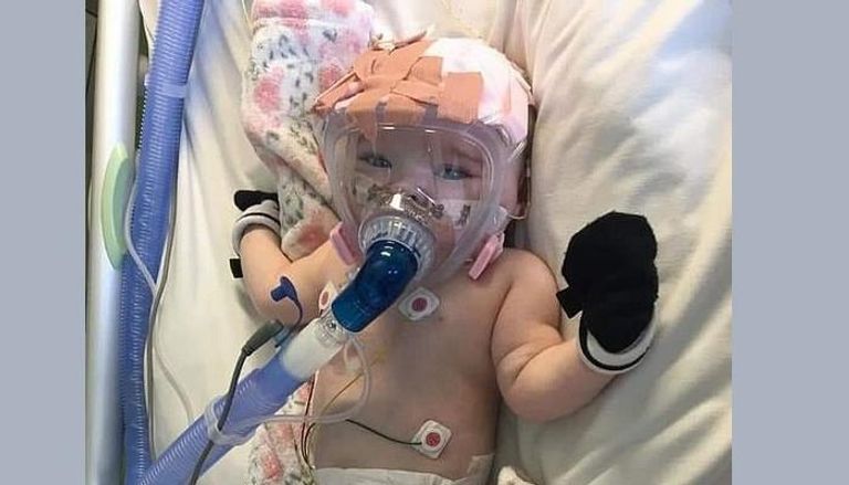 الرضيعة البريطانية إيرين بيتس مصابة بكورونا وهي تعاني من القلب
