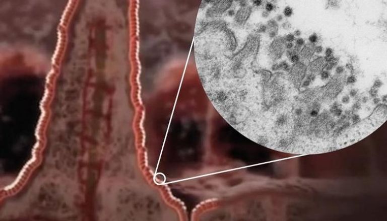  رسم لخلية بالأمعاء مع تكبير صورة مجهرية لفيروس كورونا