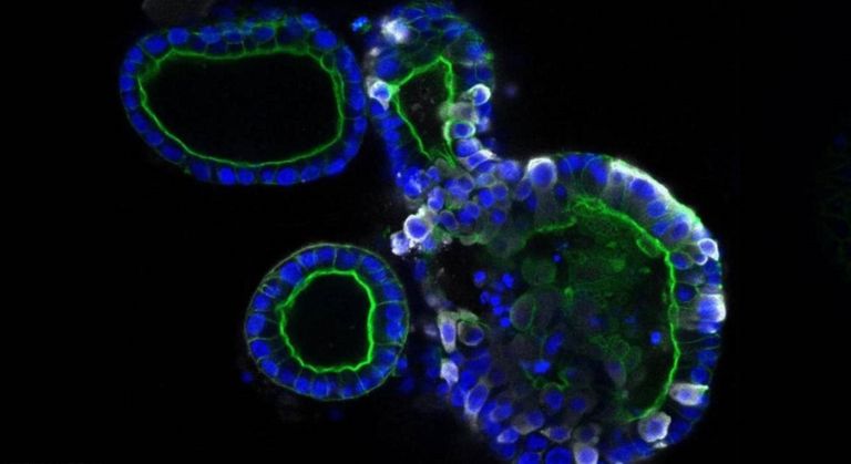 شكل فيروس كورونا تحت المجهر