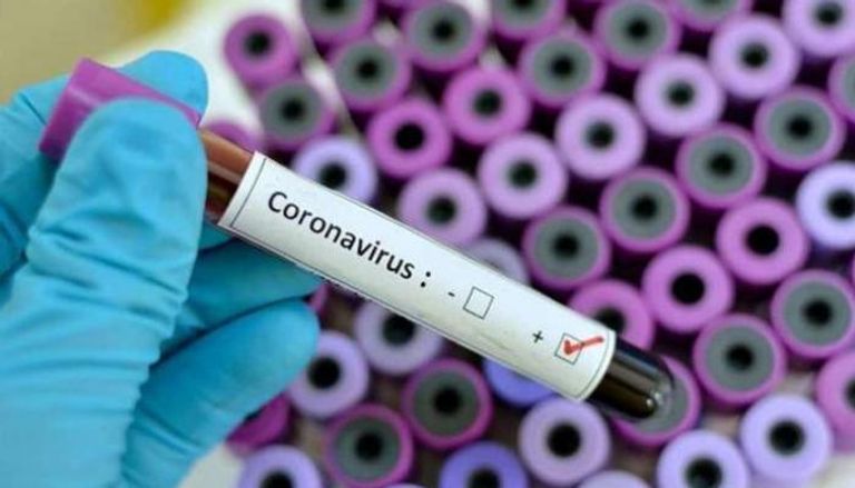 عينة إيجابية لشخص مصاب بفيروس كورونا