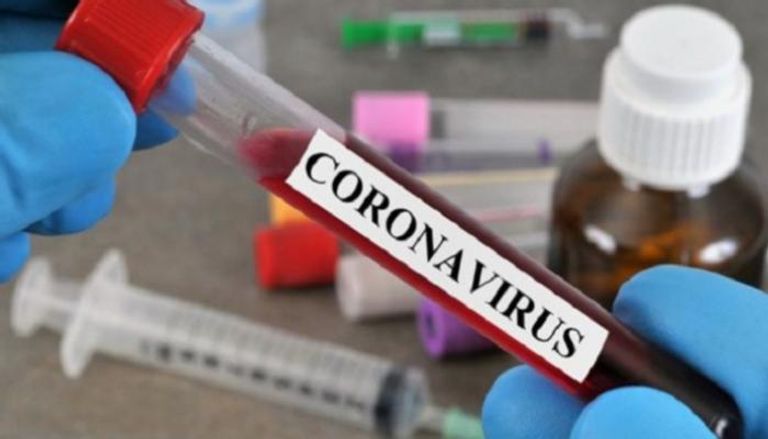 اختبار فيروس كورونا