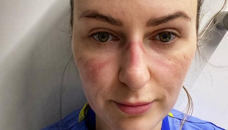 نصائح بسيطة لتجنب تهيج البشرة في زمن كورونا