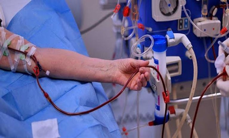 غسيل الكلى مضاعفات كورونا تحاصر 14 مليون جزائري