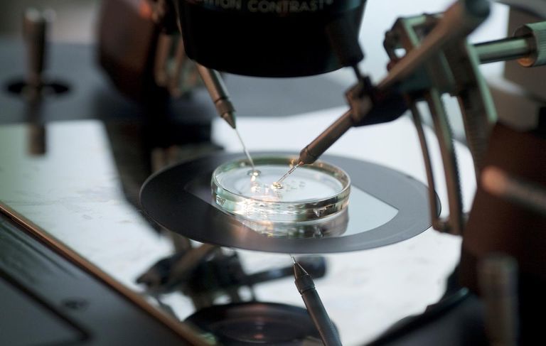 الإخصاب خارج الجسم يتطلب عدة معايير لاختيار العيادة المناسبة