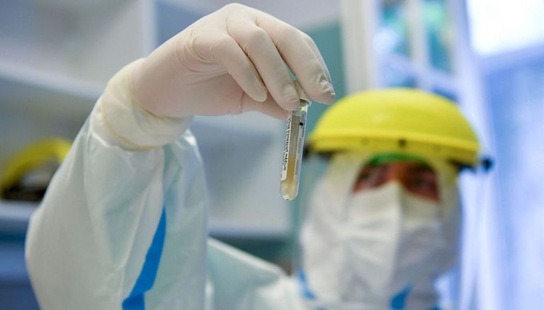 طبيب إيطالي يحمل عينات قبل إجراء فحوص كورونا عليها