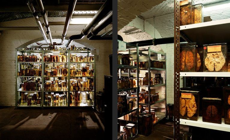 الرئة لطفل توفي وعمره عامين