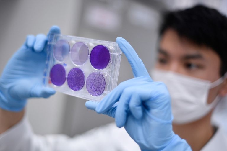 ارتفاع إصابات كورونا حول العالم