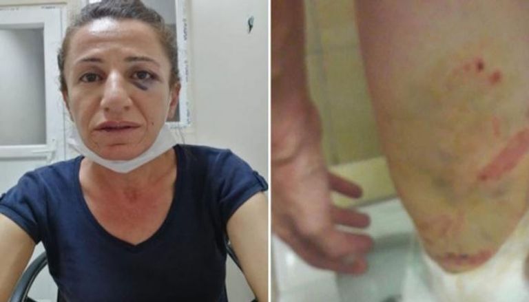 السيدة الكردية التي عذبتها الشرطة التركية