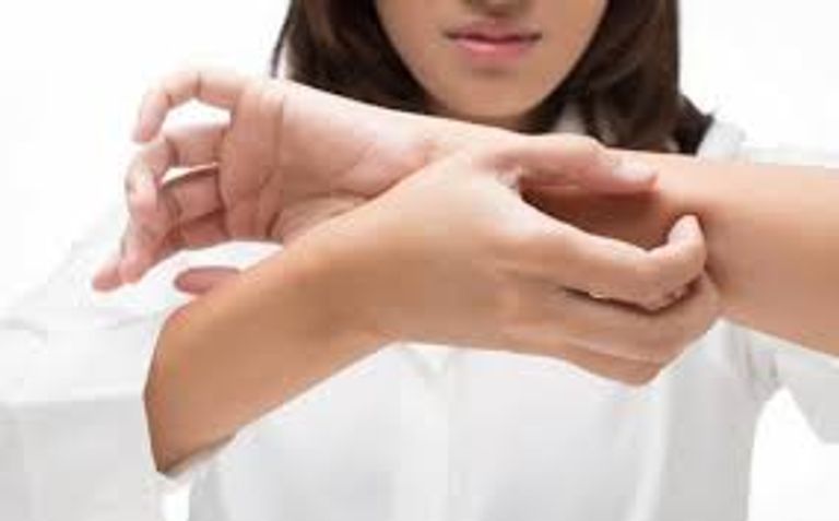  6 أمراض تنقلها لدغات البعوض