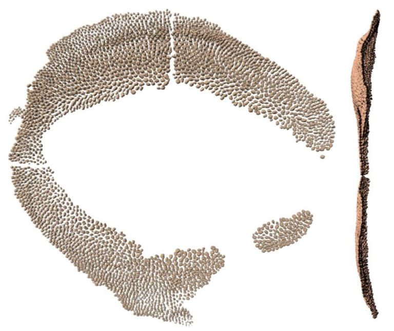 القرش الحوتي