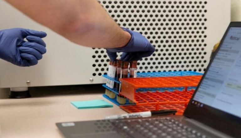 اختبار فيروس كورونا المستجد