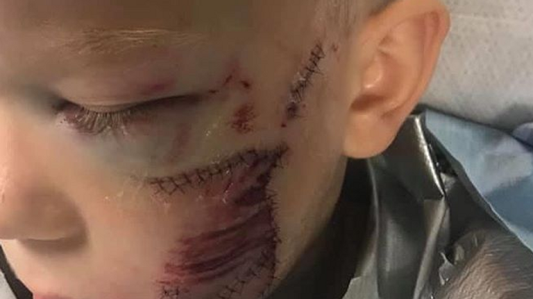 الصبي الشجاع وشقيقته