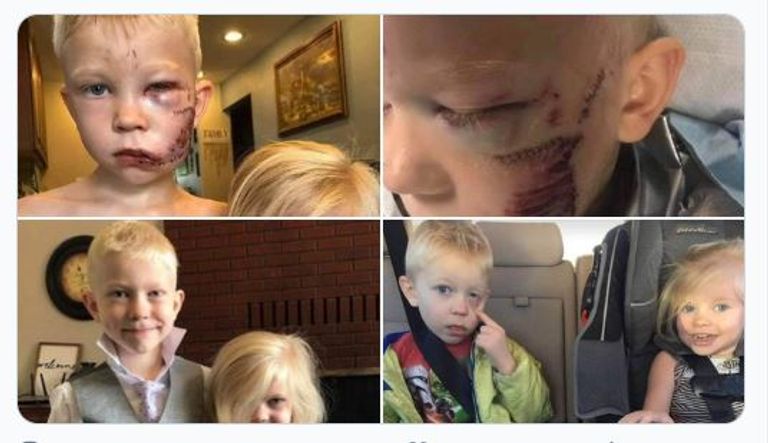 الصبي الشجاع وشقيقته