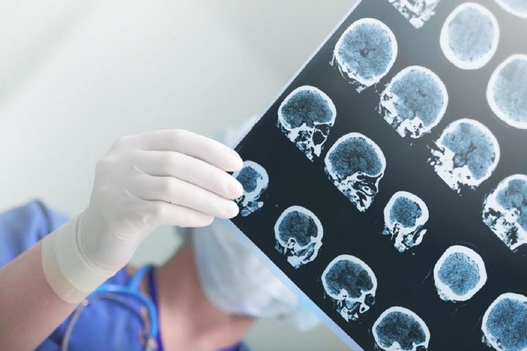 الأطباء قالوا إن اللهجة التي يتحدث بها المريض هي سلافية