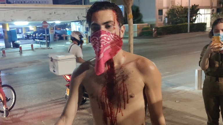 شرطي يجثو على رقبة متظاهر 