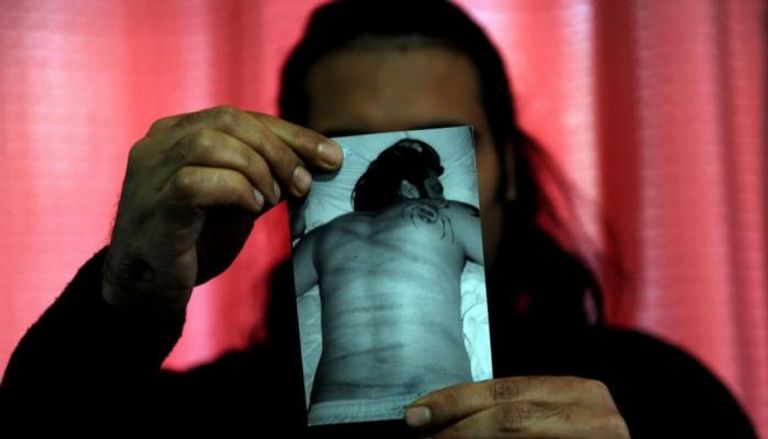 صورة متهم تعرض لتعذيب بدني في إيران - أرشيفية