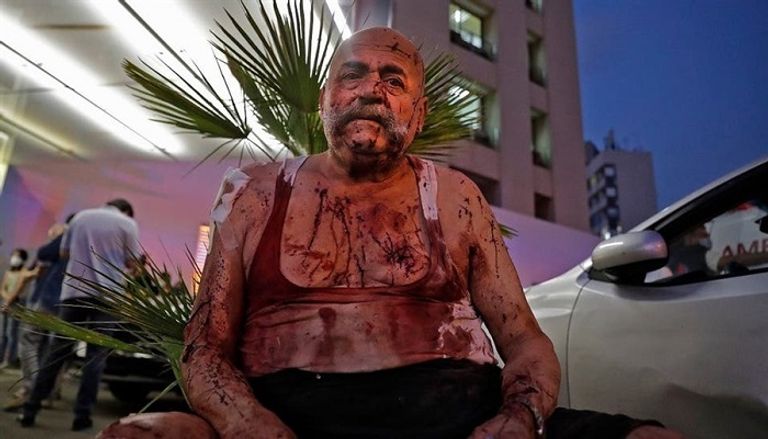 أحد مصابي الانفجار الضخم الذي ضرب مرفأ بيروت