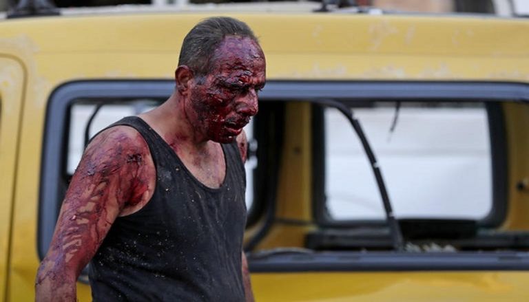 أحد مصابي الانفجار الضخم الذي ضرب مرفأ بيروت في لبنان ورجح البعض أنه ناجم عن هجوم بقنبلة